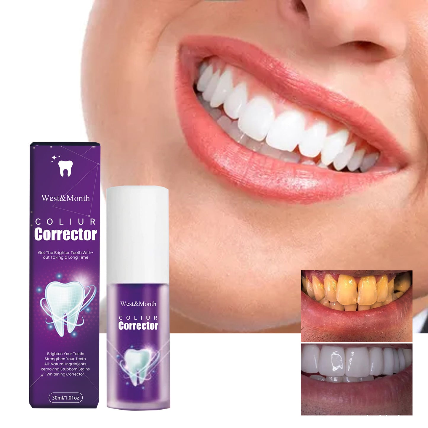 Purple Teeth Whitening Toothpaste – Stain Removal & Fresh Breath Care